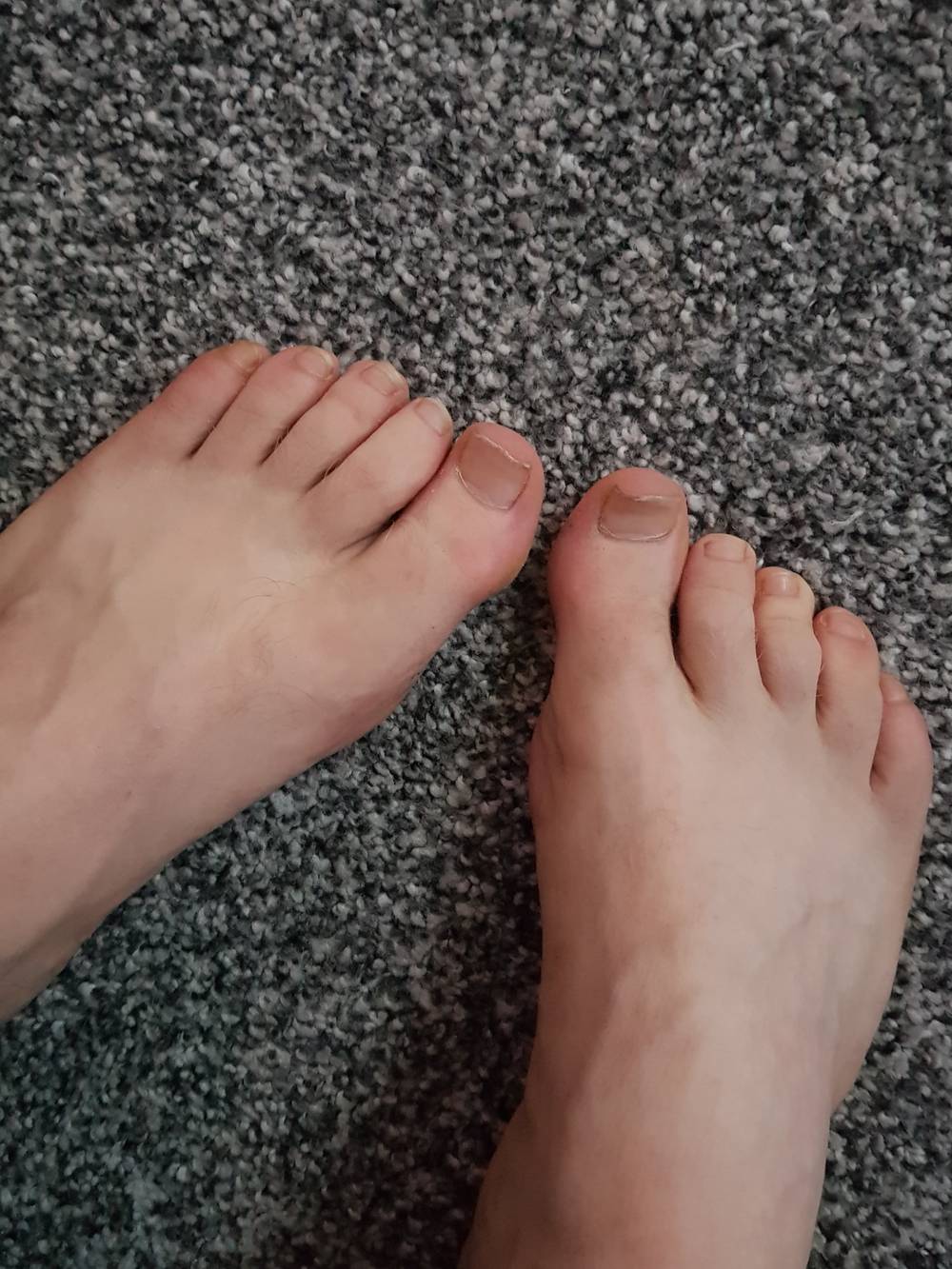 Foot Fanatics OnlyFans – free nudes, naked, leaked