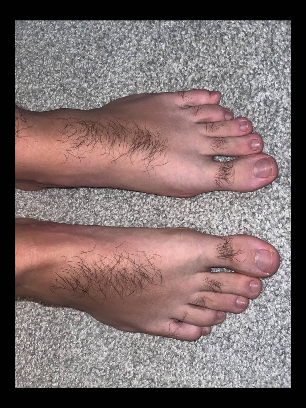 Hairy Toes OnlyFans – free nudes, naked, leaked