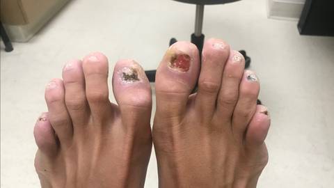 No Toenails Goddess